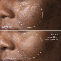 C-Tetra™ Advanced Gel-Serum